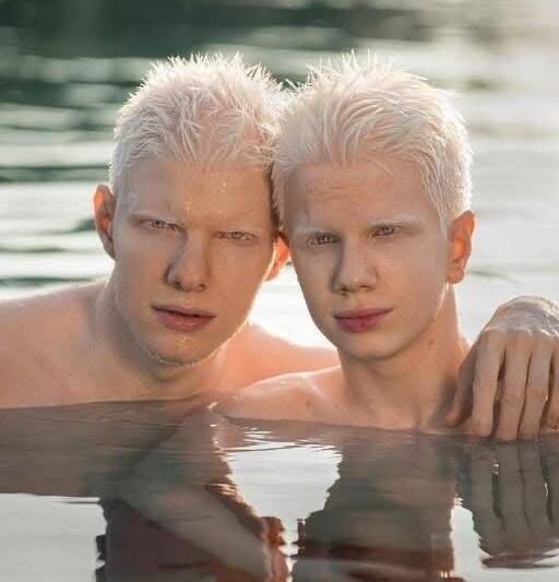 Dva bratři, oba albíni, se narodili do nejbohatší gruzínské rodiny 🧬🇬🇪  Bera se stal hudebníkem, kterého lidé milovali pro jeho talent a pokoru. Jeho bratr Tsotne maluje, působí jako model a otáčí hlavou, kamkoli přijde. ✨  Ale co lidi překvapuje nejvíc… je to, jak přízemně celá jejich rodina působí – obyčejná každodennost, přesto v ní cítíte luxus, tradici a něco, co nelze napodobit.  Podívejte se na vzácné rodinné fotografie v komentářích níže 👇