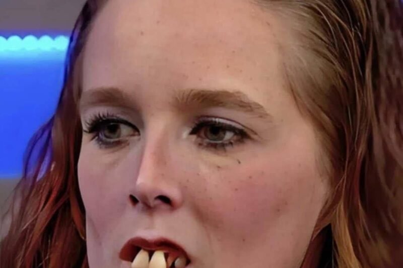 👉 Celé roky si lidé z Gemmy dělali legraci kvůli jejím zubům 🤢😬. Měla vážné problémy, které ji činily terčem posměchu 😤. Nedávno však podstoupila úpravu, která jí, jak sama přiznává, změnila život 🫢🤯. Fotky před a po rozbouřily síť – podívat se na ně můžete v komentářích! 👇