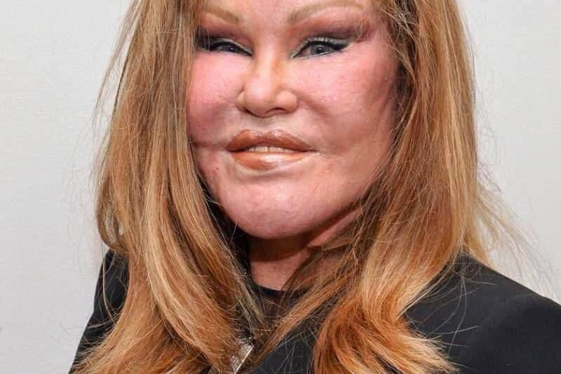 😱🤫 Lidé ji znají jako Catwoman, ale málokdo viděl, jak vypadala před proměnou… Jocelyn Wildenstein podstoupila nespočet plastických operací, které z ní vytvořily zcela nepoznatelnou osobu. Kdysi andělská kráska se proměnila do podoby, která šokuje a vyvolává údiv – fanoušci ani nevěří, že jde o tu samou ženu. Každý detail její proměny fascinuje a zároveň vyvolává otázky, co všechno stálo za tak radikální změnou. Zadržte dech a podívejte se na její archivní fotky v komentářích 👇