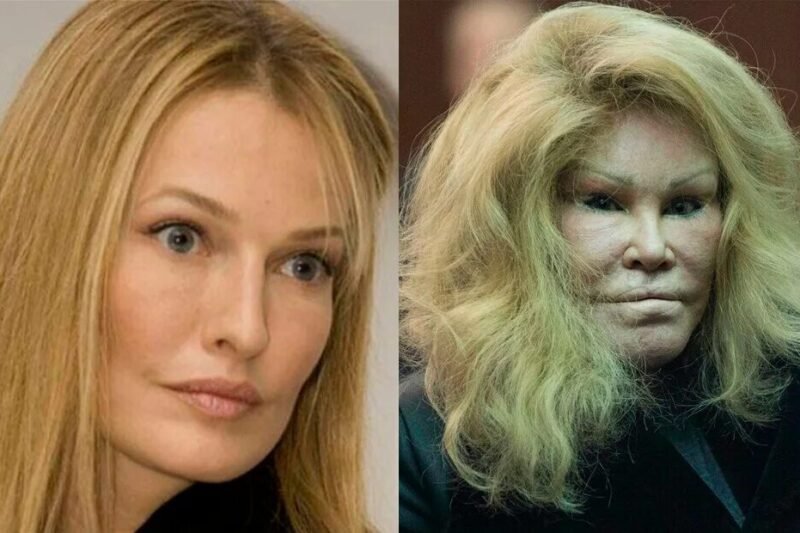 😲 Lidé ji znají jako Catwoman, ale jen málokdo ji viděl před její šokující proměnou! 🧐🤫 Jocelyn Wildenstein podstoupila nespočet plastických operací, které úplně změnily její tvář… a svět zůstal v úžasu! 😬💥  Tehdy byla andělsky krásná 😇✨, dnes ji někteří označují za monstrózní stvoření 😱🤮. Její proměna vyvolala tisíce diskuzí, šokovaných reakcí a neuvěřitelnou zvědavost po celém internetu 🌍🔥.  Zadržte dech a připravte se na archivní fotky, které ukazují, jak dramaticky se změnila! 📸👀 Klikněte do komentářů a objevte šokující rozdíl mezi minulostí a současností, který vás zaručeně ohromí, pobaví a donutí se zamyslet nad tím, co znamená krása a posedlost dokonalostí! 💬🔥👇